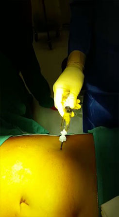 Medicina rigenerativa